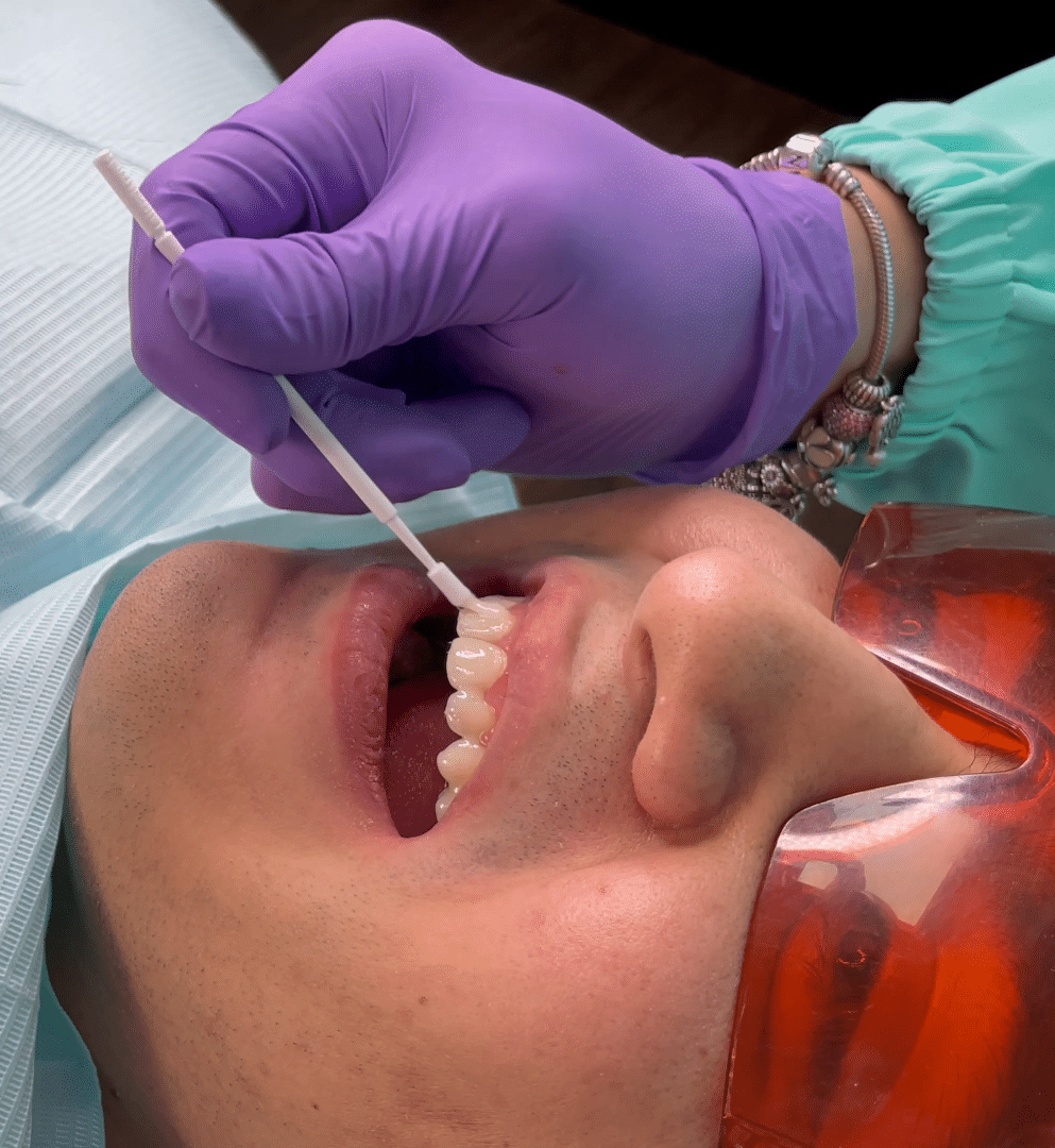 Dra. Natalia Morales aplicando un barniz dental a un paciente para evitar sensibilidad