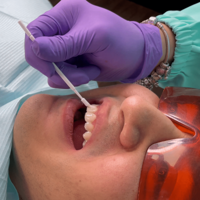 Dra. Natalia Morales aplicando un barniz dental a un paciente para evitar sensibilidad